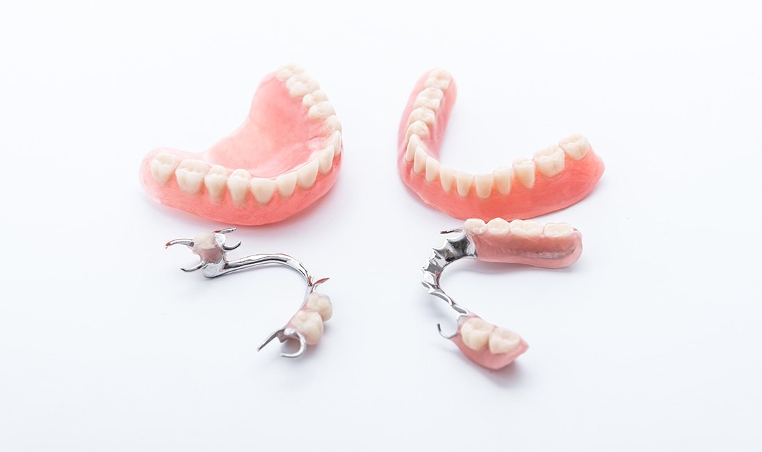 Full and partial dentures arranged against neutral backdrop