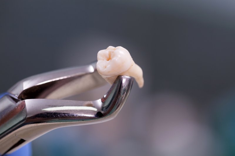 A closeup of dental forceps holding an extracted tooth